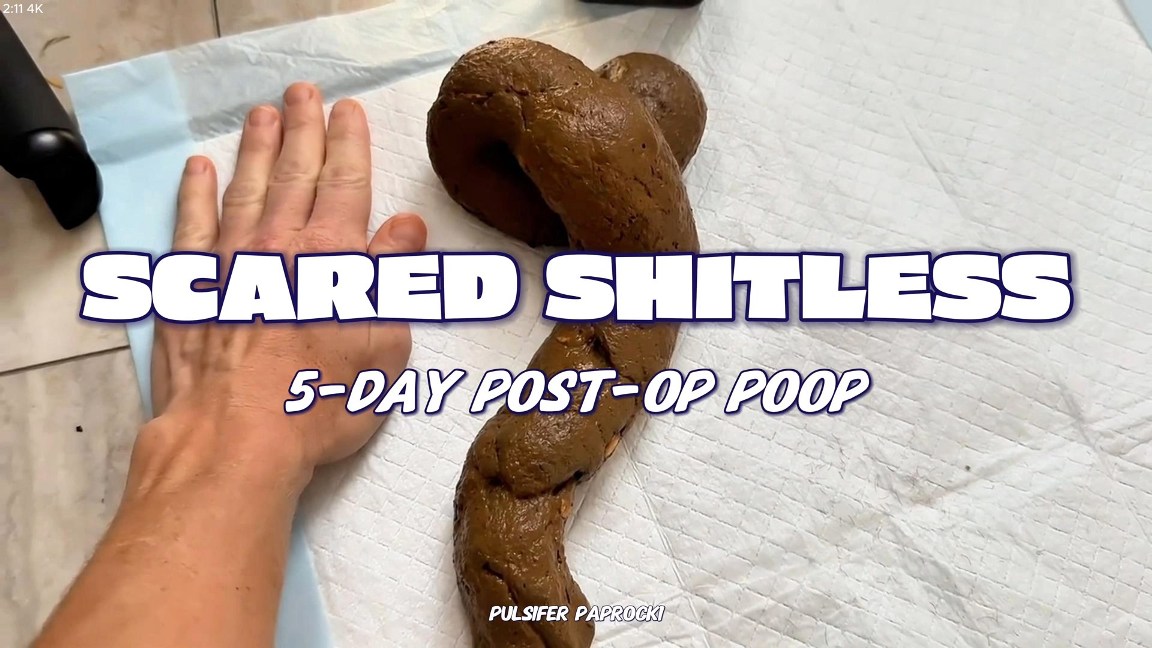Scared Shitless 5 Day Post-op Poop.